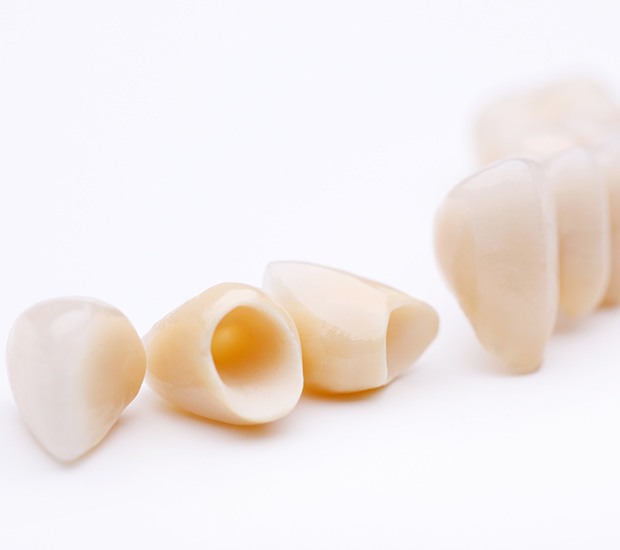 Middleburg Dental Crowns and Dental Bridges