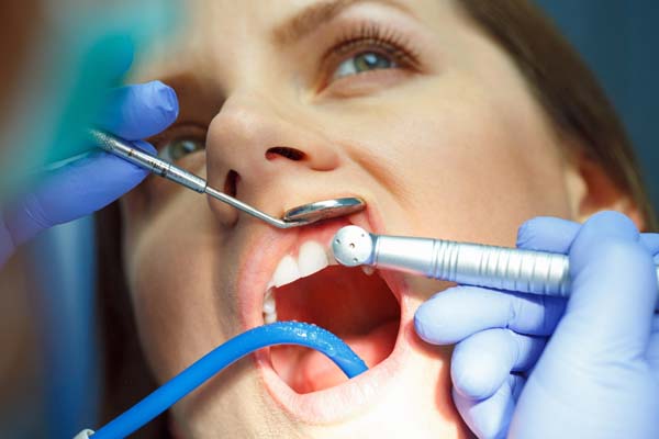 Dental Restoration: Learn About Fillings