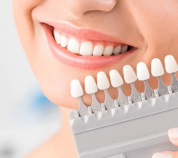 Middleburg Dental Veneers and Dental Laminates