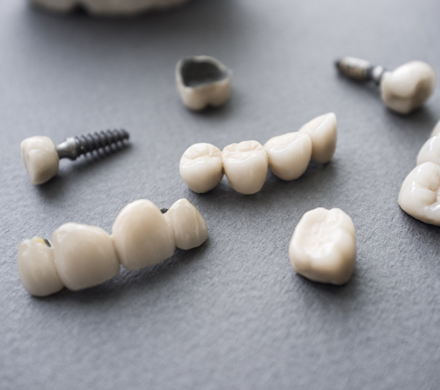 Middleburg The Difference Between Dental Implants and Mini Dental Implants