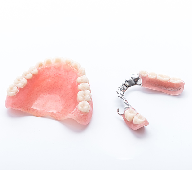 Middleburg Partial Dentures for Back Teeth