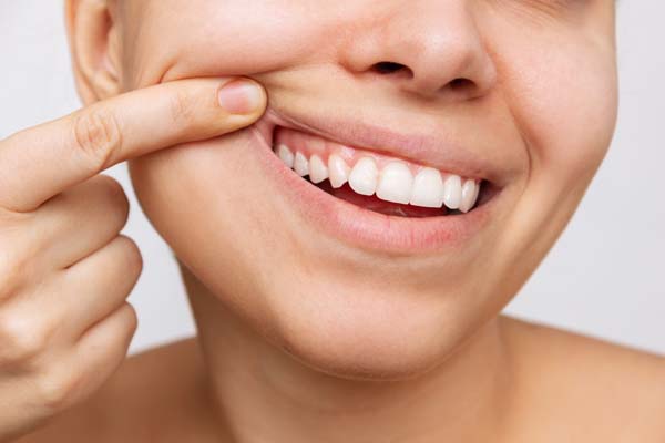 The Benefits Of At Home Teeth Whitening Trays