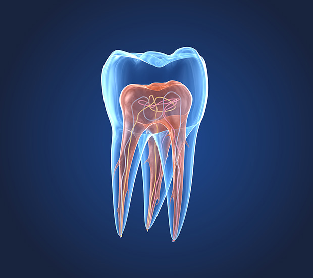 Middleburg What is an Endodontist